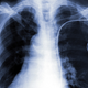 Image for article titled Someone Check on Grandpa: Mass Murder Via Pacemaker Hack Is Now Possible